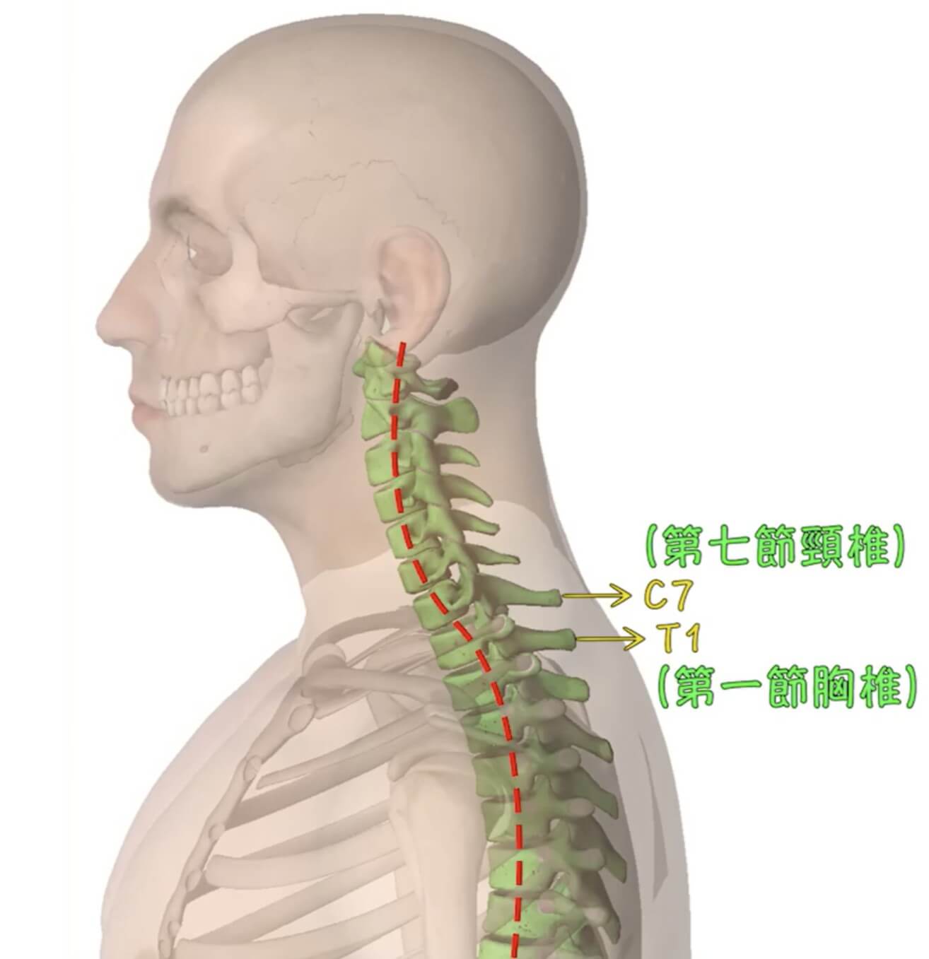 頸椎第七節與胸椎第一節交界處（C7-T1）